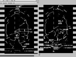 Software Accessories